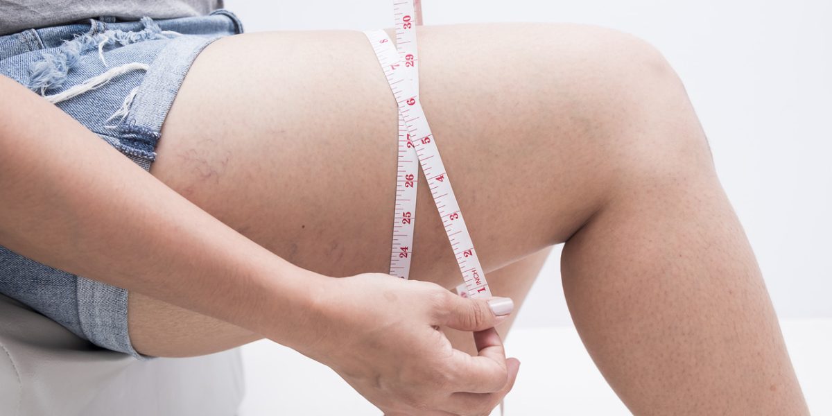 is-it-possible-to-lose-thigh-fat-in-two-weeks?