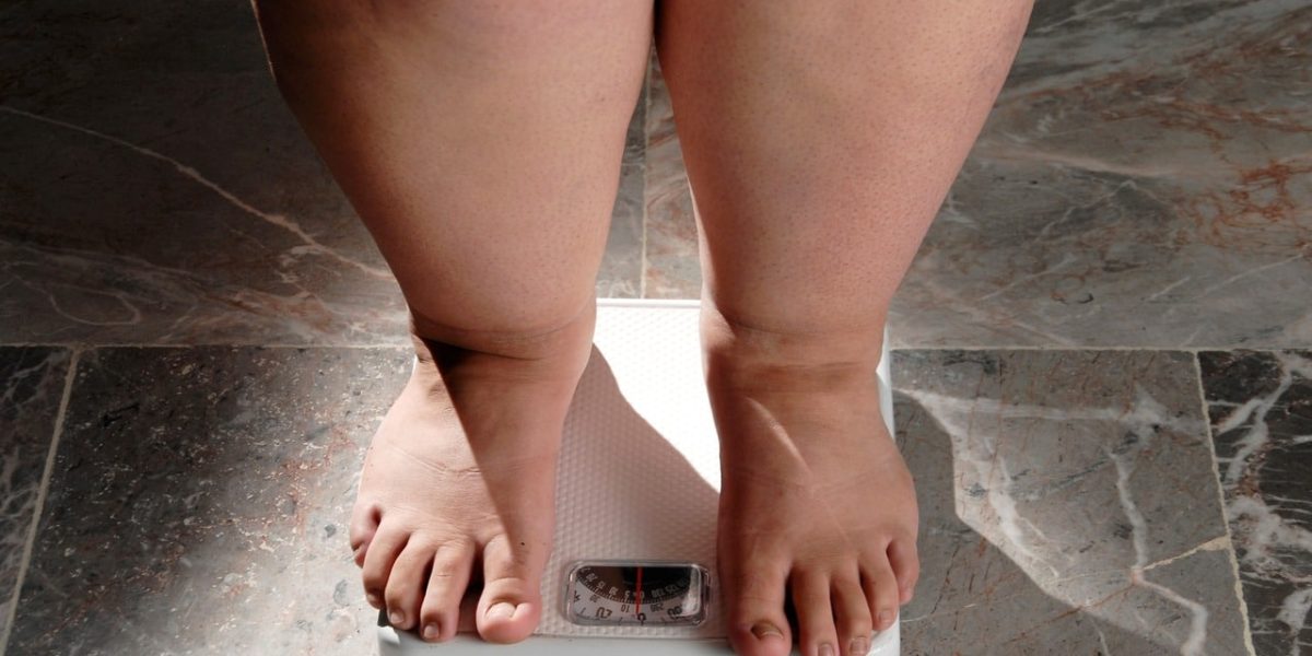 morbid-obesity:-causes,-treatment-and-more